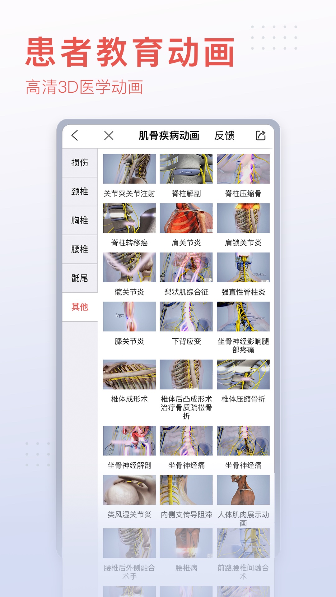 3DBody解剖截图